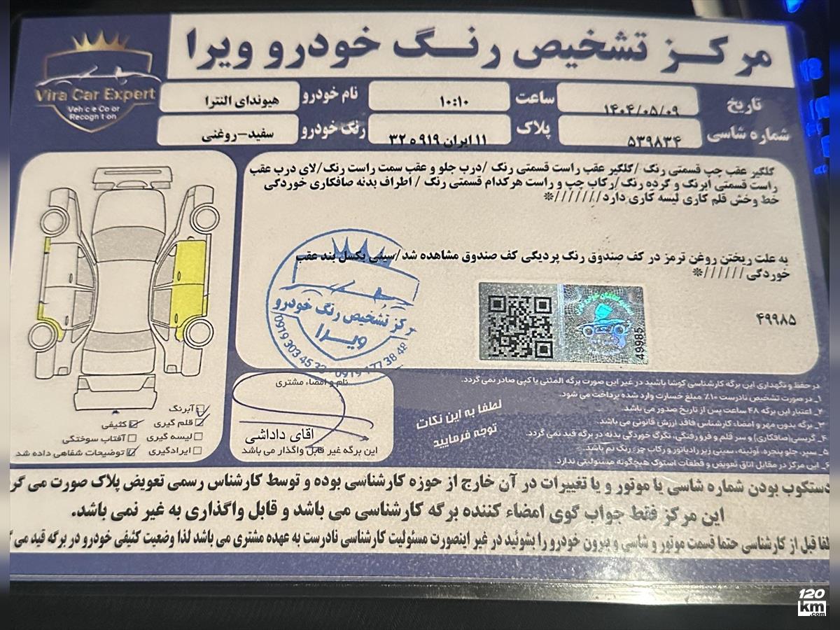 فروش هیوندای النترا HD ۲۰۱۶ سفید چند لکه رنگ تهران جردن (آفریقا) (۱۲ مرداد ۱۴۰۴)